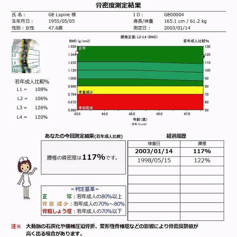 骨密度測定装置