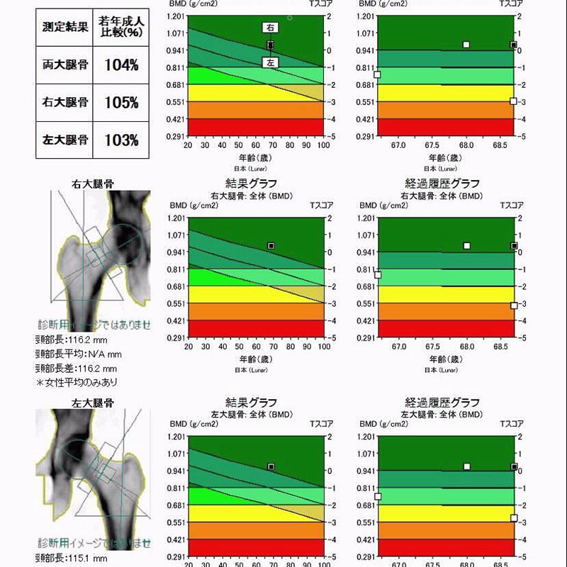 骨密度測定装置